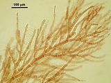 7 – “Bouquets” di cellule madri delle spermatocisti sulle pinnule di 2° e 3° ordine